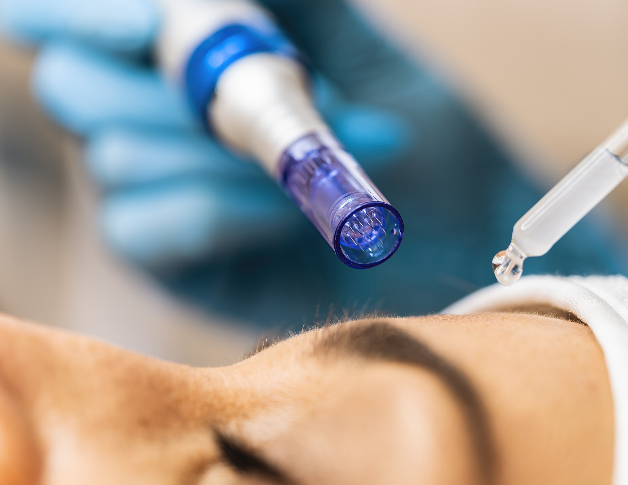 10.Dermapen Facial